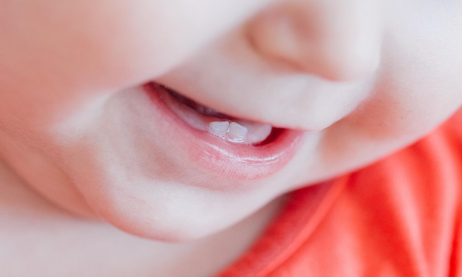 What to Expect During Teething What to Expect During Teething
